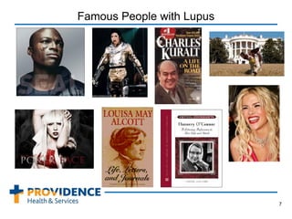 Famous People with Lupus
7
 