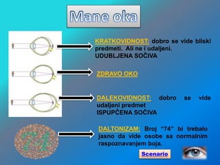 KRATKOVIDNOST: dobro se vide bliski
predmeti. Ali ne i udaljeni.
UDUBLJENA SOČIVA
ZDRAVO OKO
DALEKOVIDNOST: dobro se vide
udaljeni predmet
ISPUPČENA SOČIVA
DALTONIZAM: Broj “74” bi trebalo
jasno da vide osobe sa normalnim
raspoznavanjem boja.
Scenario
 