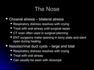 The Nose
The Nose
 Choanal atresia – bilateral atresia
Choanal atresia – bilateral atresia
 Respiratory distress resolves with crying
Respiratory distress resolves with crying
 Treat with oral airway until surgical repair
Treat with oral airway until surgical repair
 CT scan often used in surgical planning
CT scan often used in surgical planning
 ENT surgeons make opening in bony plate and stent
ENT surgeons make opening in bony plate and stent
open during healing
open during healing
 Nasolacrimal duct cysts – large and bilat
Nasolacrimal duct cysts – large and bilat
 Respiratory distress resolves with crying
Respiratory distress resolves with crying
 Treat with oral airway
Treat with oral airway
 Can usually be seen with otoscope
Can usually be seen with otoscope
 