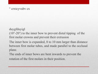 ° crxtcyvubv cx
duygfduyigl
(10°-20°) to the inner bow to prevent distal tipping of the
first molar crowns and prevent their extrusion
The inner bow is expanded, 8 to 10 mm larger than distance
between first molar tubes, and made parallel to the occlusal
plane.
The ends of inner bows are bent inwards to prevent the
rotation of the first molars in their position.
 