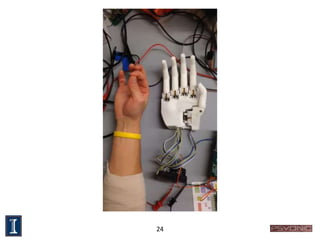 Senior Design - Myoelectric Prosthetic Hand | PPTX