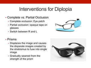 Interventions for Diplopia
•  Complete vs. Partial Occlusion
•  Complete occlusion: Eye patch
•  Partial occlusion: opaque tape on
glasses
•  Switch between R and L
•  Prisms
•  Displaces the image and causes
the disparate images created by
the strabismus to fuse into single
image
•  Gradually weaned from the
strength of the prism
 