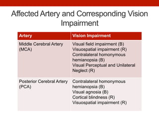 Affected Artery and Corresponding Vision
Impairment
Artery Vision Impairment
Middle Cerebral Artery
(MCA)
Visual field impairment (B)
Visuospatial impairment (R)
Contralateral homonymous
hemianopsia (B)
Visual Perceptual and Unilateral
Neglect (R)
Posterior Cerebral Artery
(PCA)
Contralateral homonymous
hemianopsia (B)
Visual agnosia (B)
Cortical blindness (R)
Visuospatial impairment (R)
 