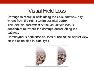 Visual Field Loss
•  Damage to receptor cells along the optic pathway, any
where from the retina to the occipital cortex
•  The location and extent of the visual field loss is
dependent on where the damage occurs along the
pathway
•  Homonymous hemianopsia: loss of half of the field of view
on the same side in both eyes
 