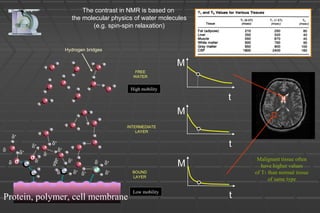 The contrast in NMR is based on
the molecular physics of water molecules
(e.g. spin-spin relaxation)
INTERMEDIATE
LAYER
FREE
WATER
Hydrogen bridges
C
C
O
O
C N BOUND
LAYER
δ+
δ+ δ+
δ+
δ-
δ-
δ-
δ+
δ+
δ- δ-
δ+
δ-
δ-
δ+
δ+δ+
δ+
Protein, polymer, cell membrane
M
M
M
t
t
tLow mobility
High mobility
Malignant tissue often
have higher values
of T1 than normal tissue
of same type
 