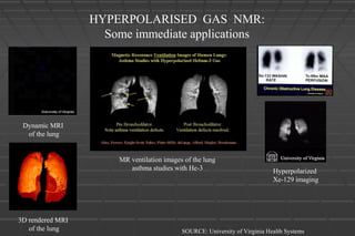Dynamic MRI
of the lung
SOURCE: University of Virginia Health Systems
MR ventilation images of the lung
asthma studies with He-3 Hyperpolarized
Xe-129 imaging
3D rendered MRI
of the lung
HYPERPOLARISED GAS NMR:
Some immediate applications
 
