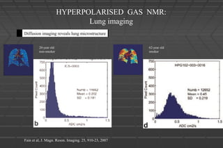 HYPERPOLARISED GAS NMR:
Lung imaging
20-year old
non-smoker
62-year old
smoker
Diffusion imaging reveals lung microstructure
Fain et al, J. Magn. Reson. Imaging. 25, 910-23, 2007
 