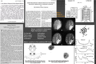 Below:
image of
a brain tumor
On the left:
Rabi’s paper
Bloch’s brief
publication
Above: Lindstrom’s observation
Right: Damadian’s patent
Below: Lauterbur’s first published MR images
Left bottom:
Mansfield’s
gradient slice
sequence
 