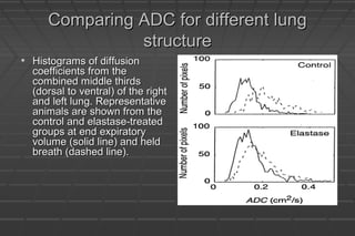 Comparing ADC for different lungComparing ADC for different lung
structurestructure
• Histograms of diffusionHistograms of diffusion
coefficients from thecoefficients from the
combined middle thirdscombined middle thirds
(dorsal to ventral) of the right(dorsal to ventral) of the right
and left lung. Representativeand left lung. Representative
animals are shown from theanimals are shown from the
control and elastase-treatedcontrol and elastase-treated
groups at end expiratorygroups at end expiratory
volume (solid line) and heldvolume (solid line) and held
breath (dashed line).breath (dashed line).
 