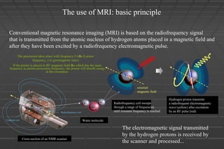 The use of MRI: basic principle
Conventional magnetic resonance imaging (MRI) is based on the radiofrequency signal
that is transmitted from the atomic nucleus of hydrogen atoms placed in a magnetic field and
after they have been excited by a radiofrequency electromagnetic pulse.
Cross-section of an NMR scanner
Water molecule
Radiofrequency coil sweeps
through a range of frequencies
until resonant frequency is reached
external
magnetic field
Cryogenic magnet
Radiofrequency coil
Gradient coil
Hydrogen proton transmits
a radiofrequent electromagnetic
wave (yellow) after excitation
by an RF pulse (red)
The electromagnetic signal transmitted
by the hydrogen protons is received by
the scanner and processed...
The precession takes place with frequency f=γB0 (Larmor
frequency, γ is gyromagnetic ratio)
If the proton is placed in RF magnetic field Brf which has the same
frequency as proton precession frequency, the proton will absorb energy
at this resonance.
 