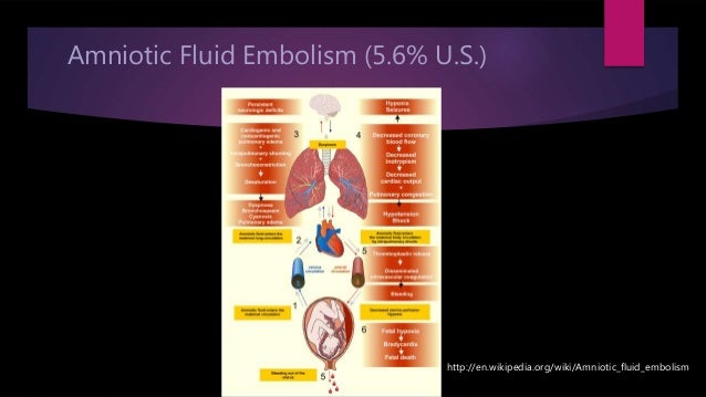 doctors who specialize in amniotic fluid embolism doctors who specialize in amniotic fluid embolism