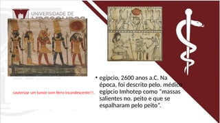 • egípcio, 2600 anos a.C. Na
época, foi descrito pelo. médico
egípcio Imhotep como “massas
salientes no. peito e que se
espalharam pelo peito”.
cauterizar um tumor com ferro incandescente!!!.
 