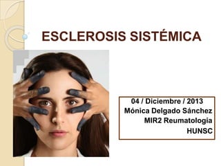 ESCLEROSIS SISTÉMICA
04 / Diciembre / 2013
Mónica Delgado Sánchez
MIR2 Reumatología
HUNSC
 