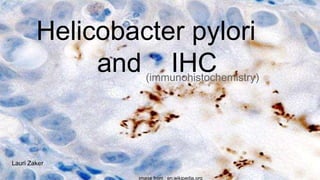 Helicobacter pylori
and IHC(immunohistochemistry)
image from : en.wikipedia.org
Lauri Zaker
 