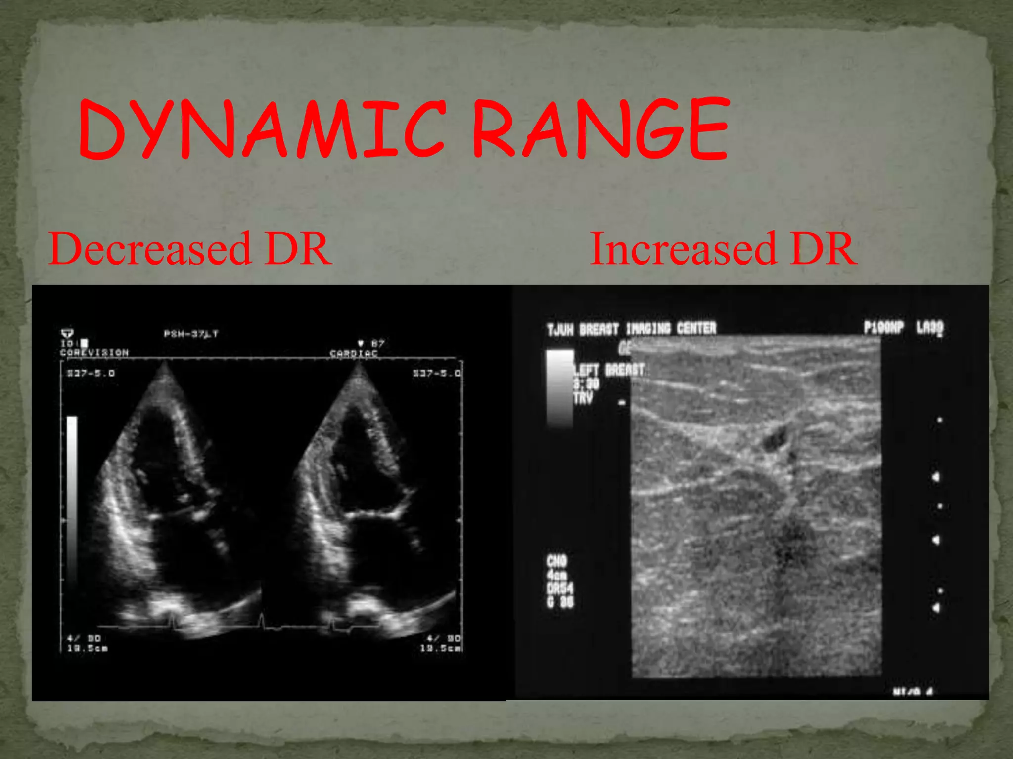 DYNAMIC RANGE
Decreased DR   Increased DR
 