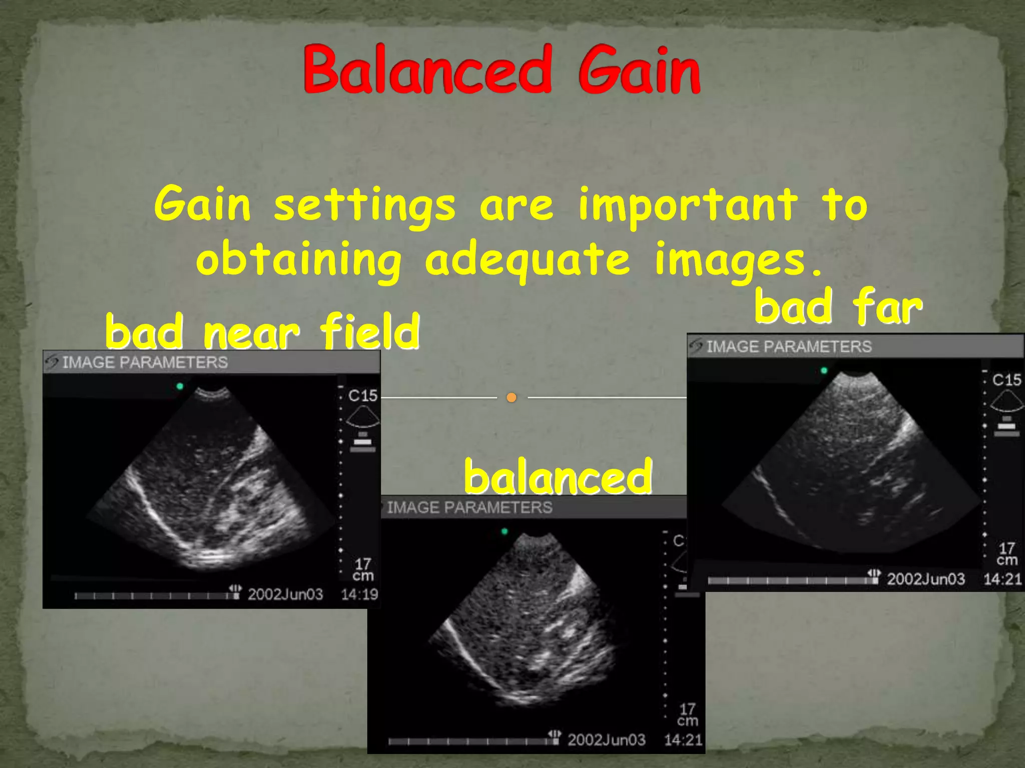 Gain settings are important to
    obtaining adequate images.
                           bad far
bad near field
                           field

              balanced
 