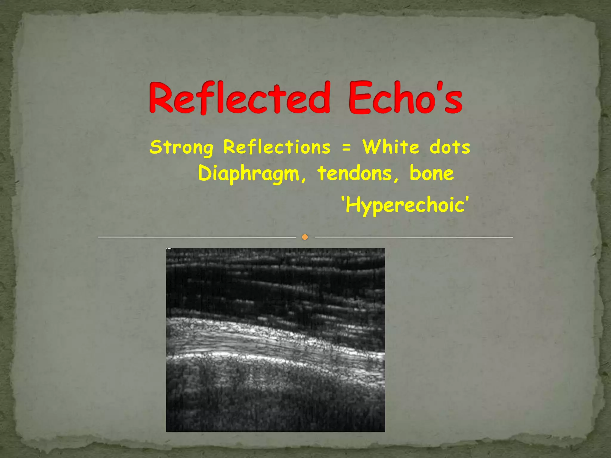 Strong Reflections = White dots
    Diaphragm, tendons, bone
                  „Hyperechoic‟
 