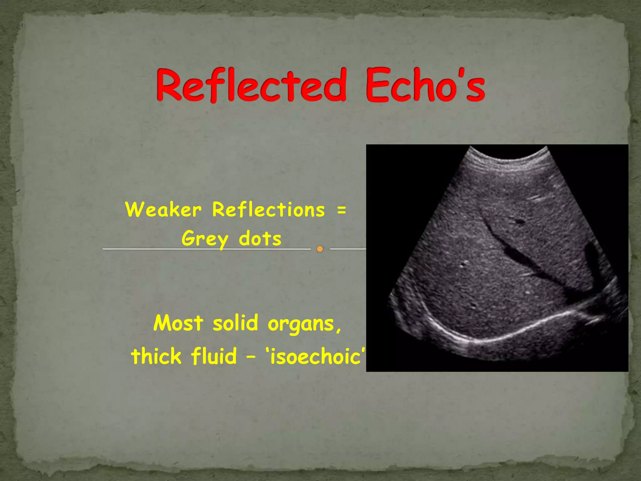 Weaker Reflections =
    Grey dots



  Most solid organs,
thick fluid – „isoechoic‟
 