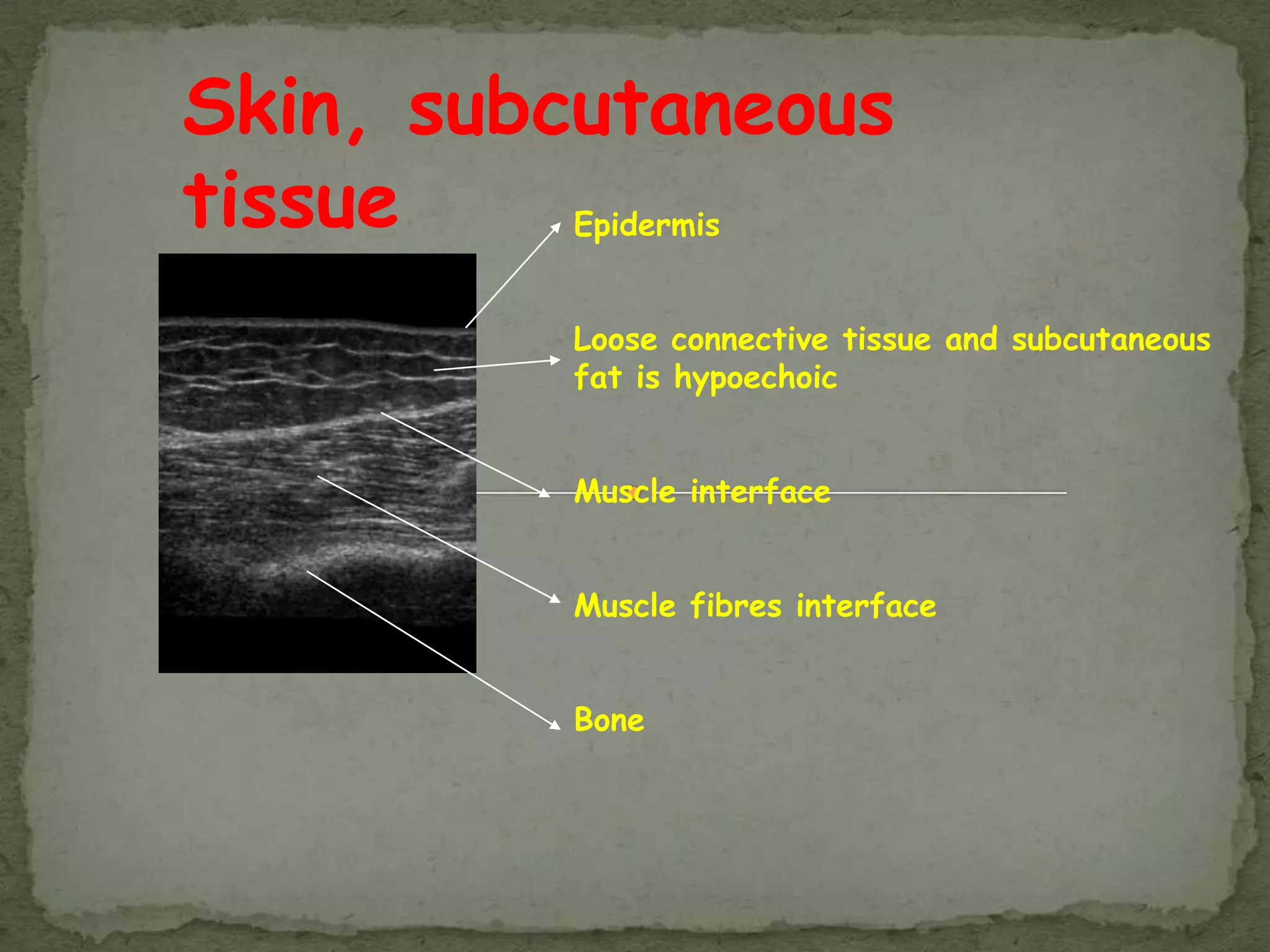 Skin, subcutaneous
tissue    Epidermis


          Loose connective tissue and subcutaneous
          fat is hypoechoic


          Muscle interface


          Muscle fibres interface


          Bone
 