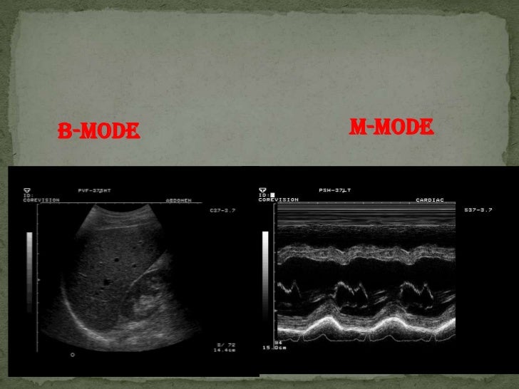 Basics of ultrasound machine