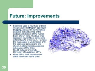 Future: Improvements Scientists used a new type of brain imaging called  diffusion spectrum imaging , along with mathematical analysis, to build a map of the cortical architecture of the human brain, shown here. The blue lines represent neural fibers connecting different parts of the brain. To make the map easier to understand, only the strongest connections are shown. Letters indicate anatomic subregions of the brain.  Credit: Indiana  University , University of Lausanne, EPFL  Uses MR to track movement of water molecules in the brain. 