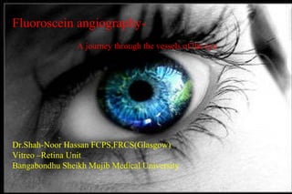 Fluoroscein angiography-
A journey through the vessels of the eye
Dr.Shah-Noor Hassan FCPS,FRCS(Glasgow)
Vitreo –Retina Unit
Bangabondhu Sheikh Mujib Medical University
 
