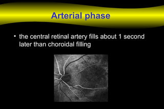 Arterial phase
• the central retinal artery fills about 1 second
later than choroidal filling
 