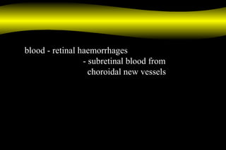 blood - retinal haemorrhages
- subretinal blood from
choroidal new vessels
 