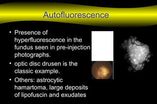 Autofluorescence
• Presence of
hyperfluorescence in the
fundus seen in pre-injection
photographs.
• optic disc drusen is the
classic example.
• Others: astrocytic
hamartoma, large deposits
of lipofuscin and exudates
 