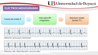 ELECTROCARDIOGRAMA
Carece de ondas P.
Intervalos RR
irregulares .
Aparecen ondas
(ondas ‘f’).
 
