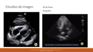 Estudios de imagen Rx de tórax
Ecografía
ATRIAL FIBRILLATION: AN APPROACH TO DIAGNOSIS AND MANAGEMENT IN THE
EMERGENCY DEPARTMENT 2021
 