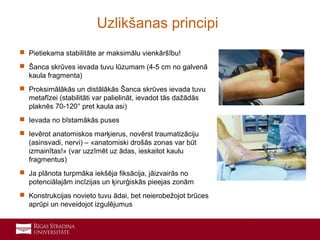 12
 Pietiekama stabilitāte ar maksimālu vienkāršību!
 Šanca skrūves ievada tuvu lūzumam (4-5 cm no galvenā
kaula fragmenta)
 Proksimālākās un distālākās Šanca skrūves ievada tuvu
metafīzei (stabilitāti var palielināt, ievadot tās dažādās
plaknēs 70-120° pret kaula asi)
 Ievada no bīstamākās puses
 Ievērot anatomiskos marķierus, novērst traumatizāciju
(asinsvadi, nervi) – «anatomiski drošās zonas var būt
izmainītas!» (var uzzīmēt uz ādas, ieskaitot kaulu
fragmentus)
 Ja plānota turpmāka iekšēja fiksācija, jāizvairās no
potenciālajām incīzijas un ķirurģiskās pieejas zonām
 Konstrukcijas novieto tuvu ādai, bet neierobežojot brūces
aprūpi un neveidojot izgulējumus
Uzlikšanas principi
 