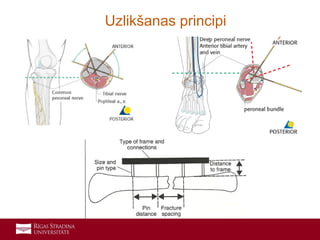 13
Uzlikšanas principi
 