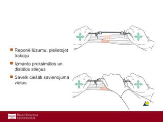 18
 Reponē lūzumu, pielietojot
trakciju
 Izmanto proksimālos un
distālos stieņus
 Savelk ciešāk savienojuma
vietas
 
