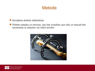 2
 Ķirurģiska skeleta stabilizācija
 Pielieto stieples un skrūves, kas tiek izvadītas caur ādu un ārpusē tiek
savienotas ar stieņiem vai citām ierīcēm
Metode
 