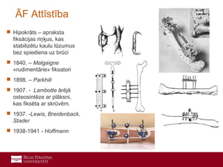 3
 Hipokrāts – apraksta
fiksācijas riņķus, kas
stabilizētu kaulu lūzumus
bez spiediena uz brūci
 1840. – Malgaigne
«rudimentārie» fiksatori
 1898. – Parkhill
 1907. - Lambotte ārējā
osteosintēze ar plāksni,
kas fiksēta ar skrūvēm.
 1937. -Lewis, Breidenback,
Stader
 1938-1941 - Hoffmann
ĀF Attīstība
 