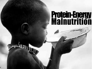 IGCSE Global Perspectives: Food Availability