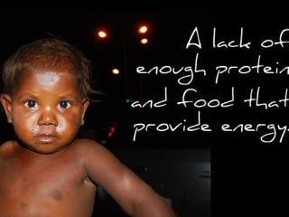 IGCSE Global Perspectives: Food Availability