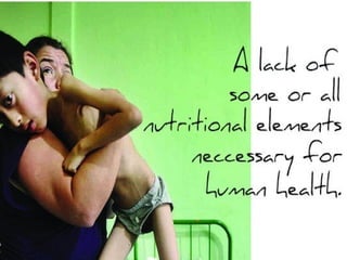 IGCSE Global Perspectives: Food Availability