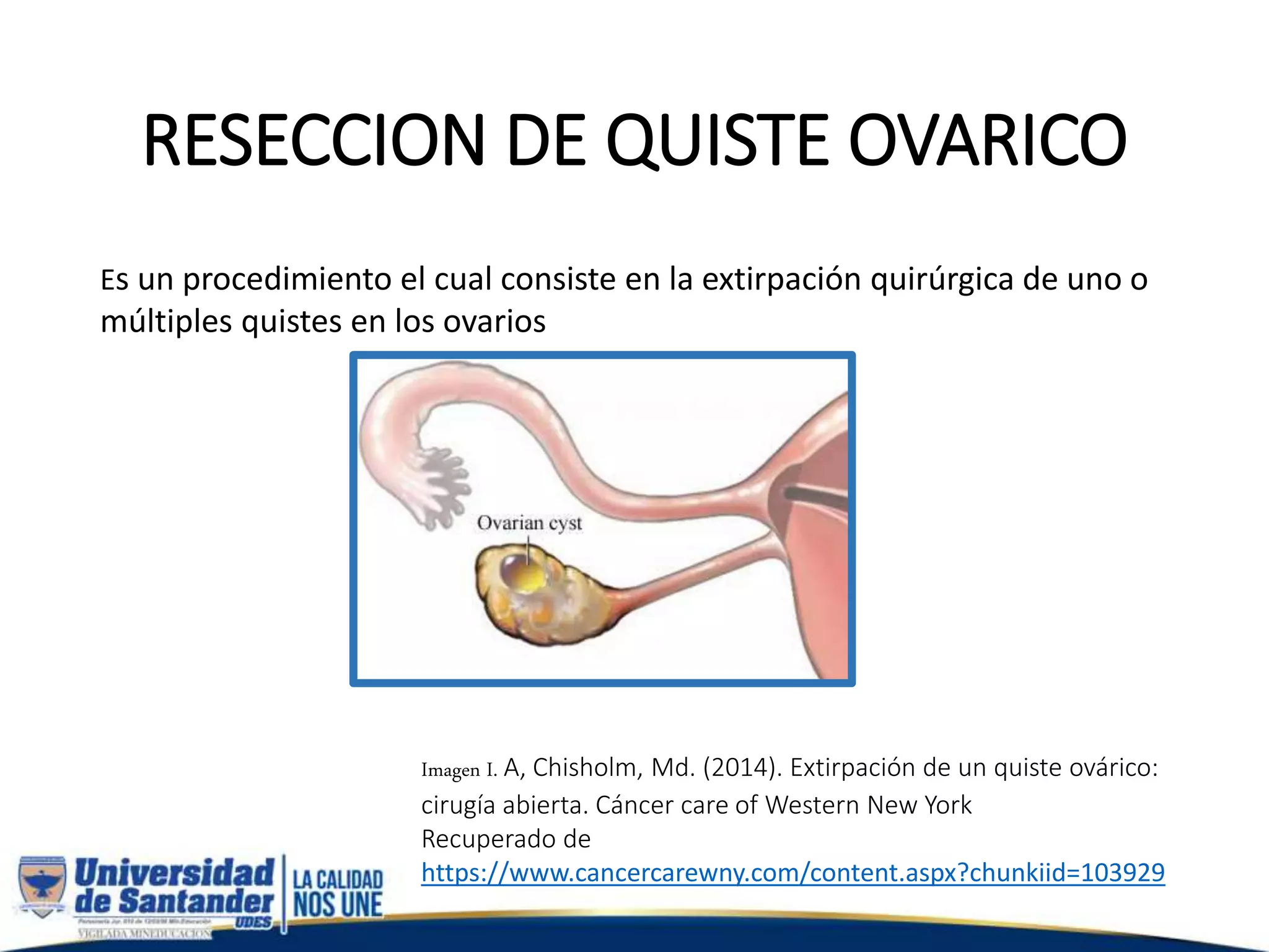 reseccion-de-quiste-ov-rico-pptx