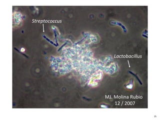 Lactobacillus
Streptococcus
25
MJ. Molina Rubio
12 / 2007
25
 