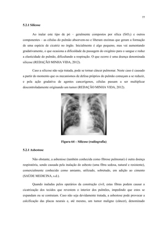 77
5.2.1 Silicose
Ao inalar este tipo de pó – geralmente compostos por sílica (SiO2) e outros
componentes – as células do pulmão absorvem-no e liberam enzimas que geram a formação
de uma espécie de cicatriz no órgão. Inicialmente é algo pequeno, mas vai aumentando
gradativamente, o que ocasiona a dificuldade da passagem do oxigênio para o sangue e reduz
a elasticidade do pulmão, dificultando a respiração. O que ocorre é uma doença denominada
silicose (REDAÇÃO MINHA VIDA, 2012).
Caso a silicose não seja tratada, pode se tornar câncer pulmonar. Neste caso é causado
a partir do momento que os mecanismos de defesa próprios do pulmão começam a se reduzir,
e pela ação gradativa de agentes cancerígenos, células passam a ser multiplicar
descontroladamente originando um tumor (REDAÇÃO MINHA VIDA, 2012).
Figura 64 – Silicose (radiografia)
5.2.1 Asbestose
Não obstante, a asbestose (também conhecida como fibrose pulmonar) é outra doença
respiratória, sendo causada pela inalação do asbesto (uma fibra sedosa, natural e resistente),
comercialmente conhecido como amianto, utilizado, sobretudo, em adição ao cimento
(SAÚDE MEDICINA, s.d.).
Quando inaladas pelos operários da construção civil, estas fibras podem causar a
cicatrização dos tecidos que revestem o interior dos pulmões, impedindo que estes se
expandam ou se contraiam. Caso não seja devidamente tratada, a asbestose pode provocar a
calcificação das placas neurais e, até mesmo, um tumor maligno (câncer), denominado
 