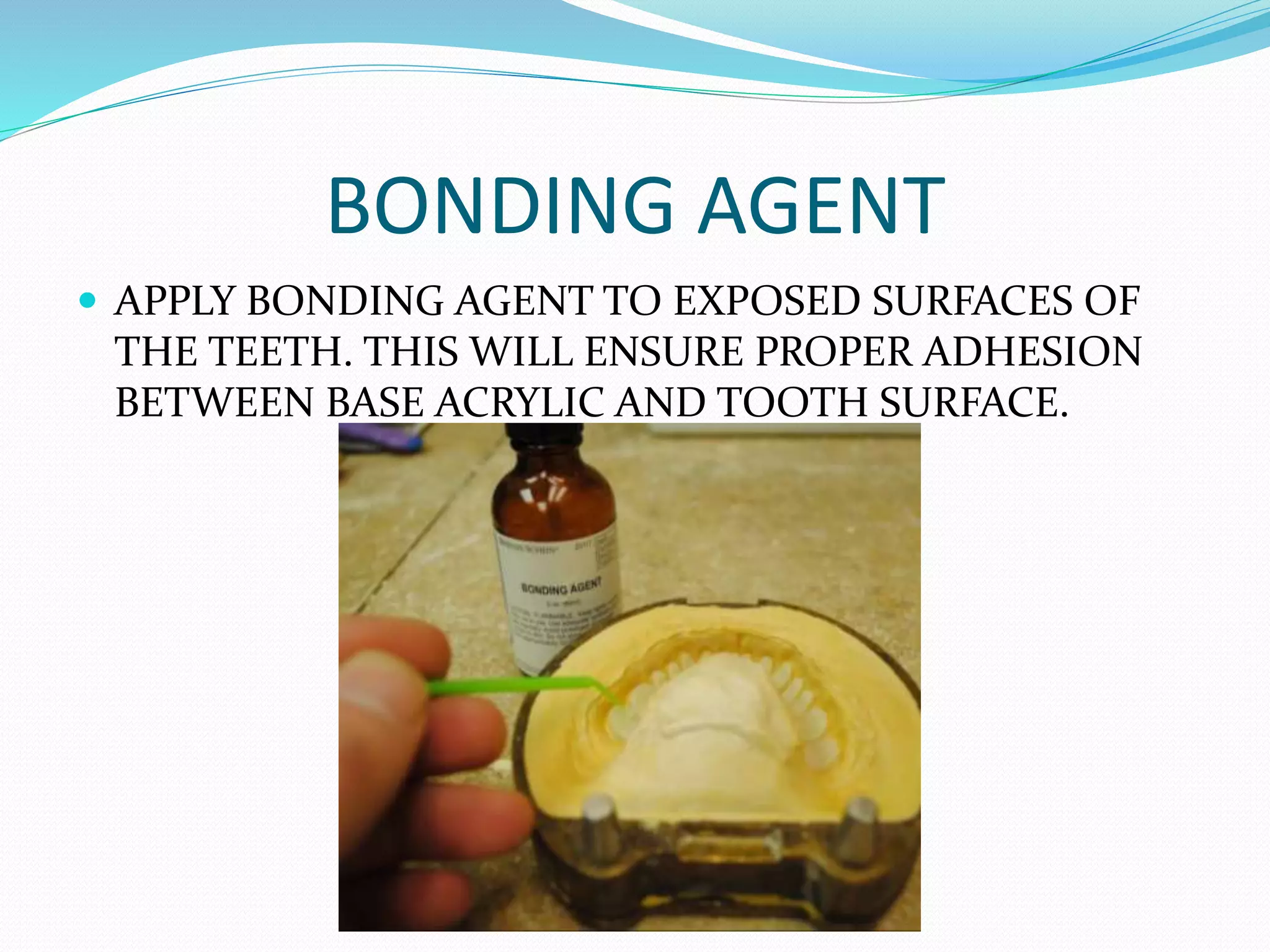 BONDING AGENT
 APPLY BONDING AGENT TO EXPOSED SURFACES OF
THE TEETH. THIS WILL ENSURE PROPER ADHESION
BETWEEN BASE ACRYLIC AND TOOTH SURFACE.
 