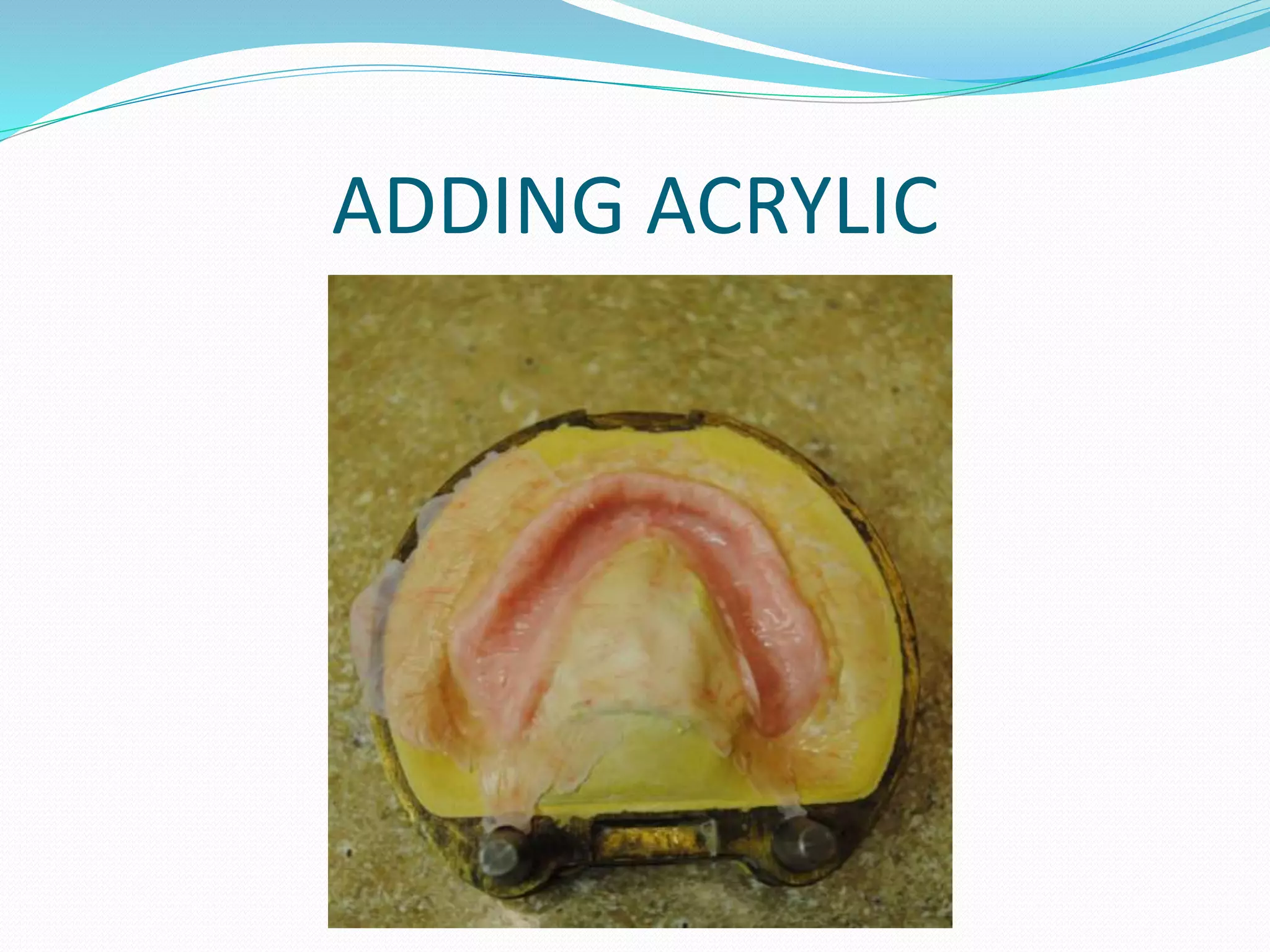 ADDING ACRYLIC
 