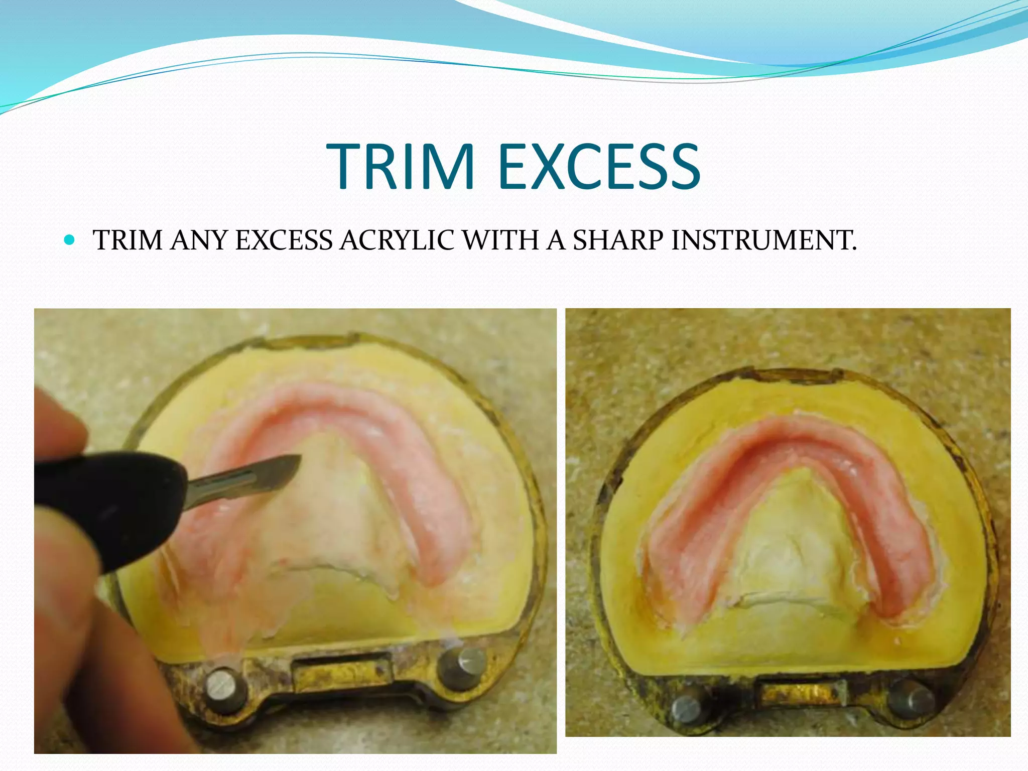 TRIM EXCESS
 TRIM ANY EXCESS ACRYLIC WITH A SHARP INSTRUMENT.
 