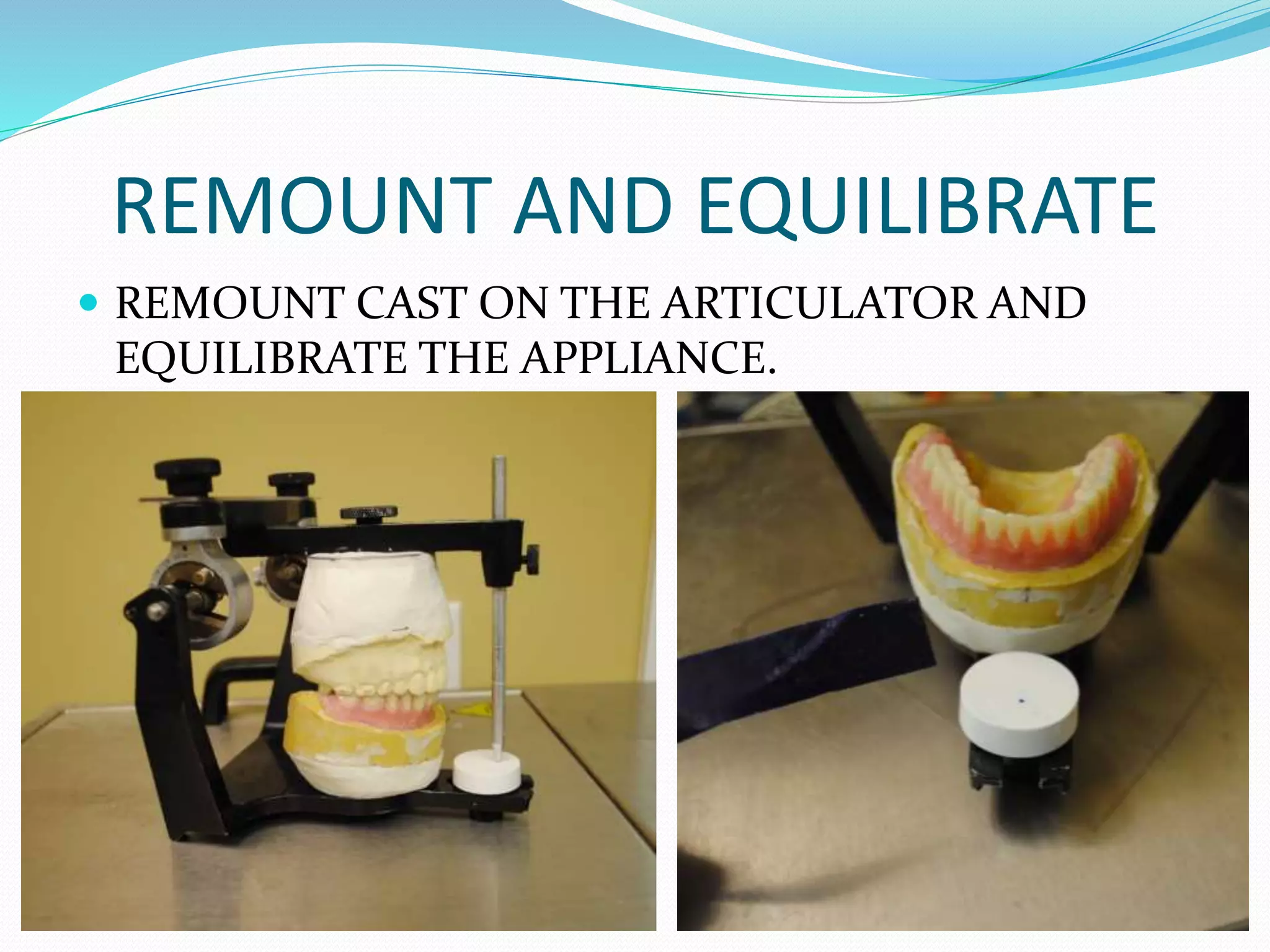 REMOUNT AND EQUILIBRATE
 REMOUNT CAST ON THE ARTICULATOR AND
EQUILIBRATE THE APPLIANCE.
 
