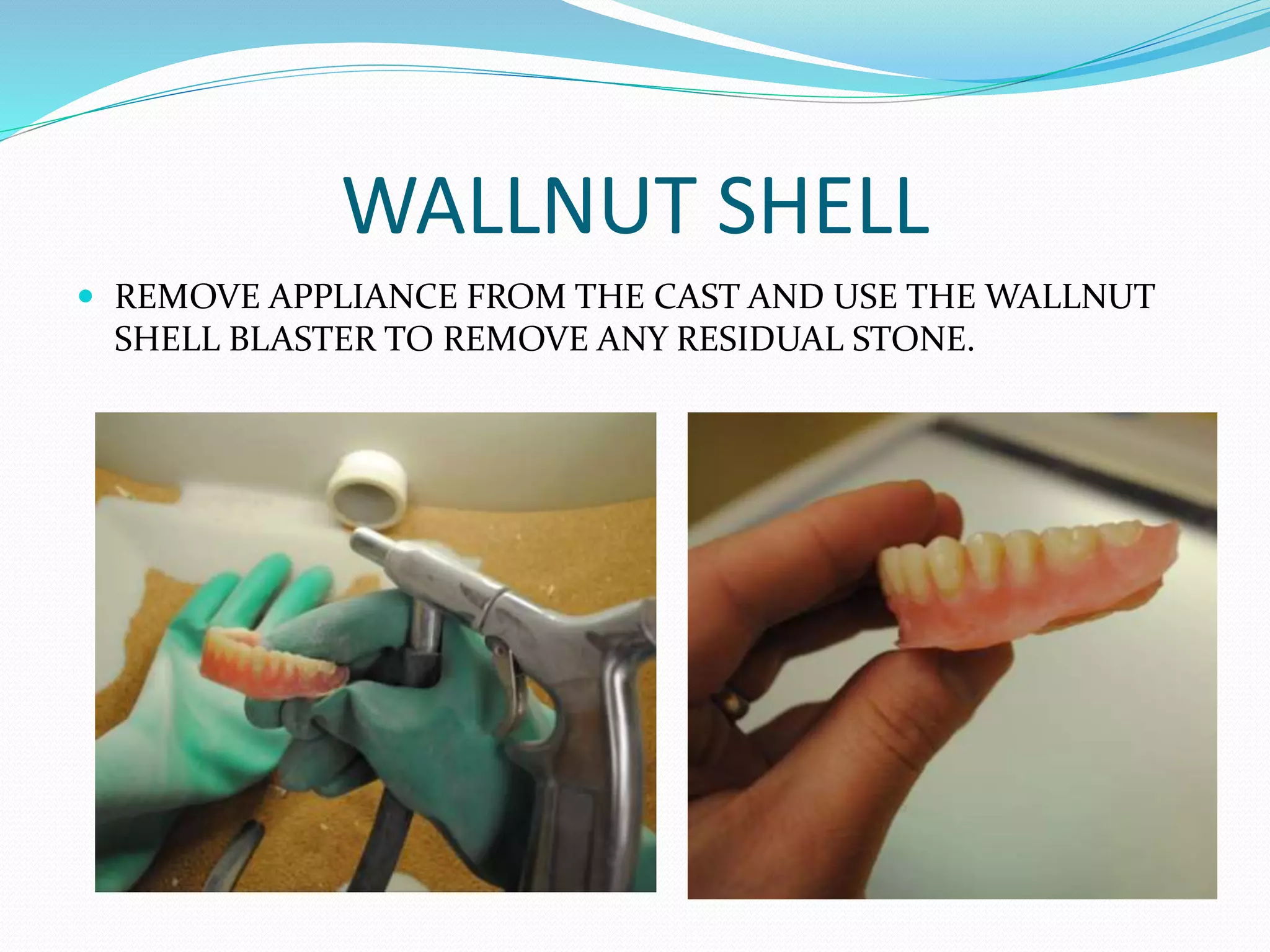 WALLNUT SHELL
 REMOVE APPLIANCE FROM THE CAST AND USE THE WALLNUT
SHELL BLASTER TO REMOVE ANY RESIDUAL STONE.
 