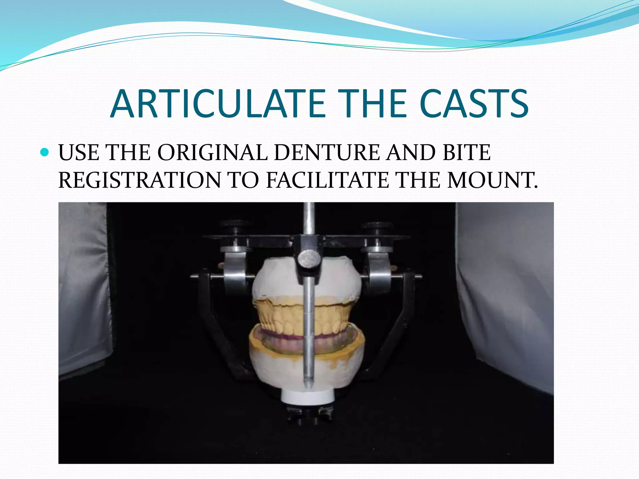 ARTICULATE THE CASTS
 USE THE ORIGINAL DENTURE AND BITE
REGISTRATION TO FACILITATE THE MOUNT.
 