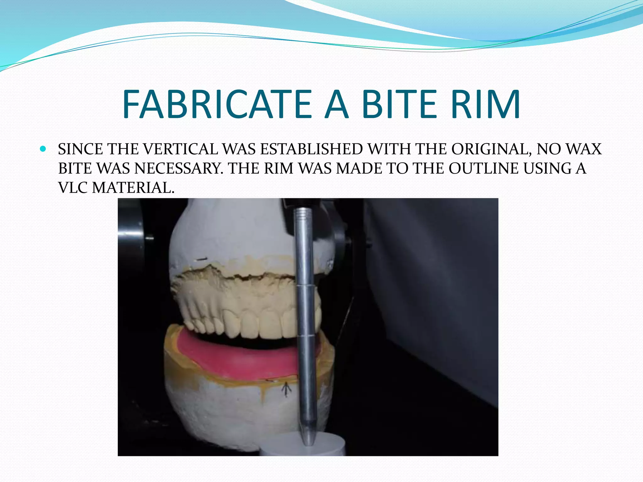 FABRICATE A BITE RIM
 SINCE THE VERTICAL WAS ESTABLISHED WITH THE ORIGINAL, NO WAX
BITE WAS NECESSARY. THE RIM WAS MADE TO THE OUTLINE USING A
VLC MATERIAL.
 