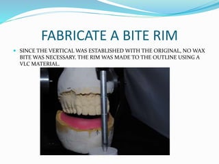 Fabrication of a new full lower denture revised | PPTX
